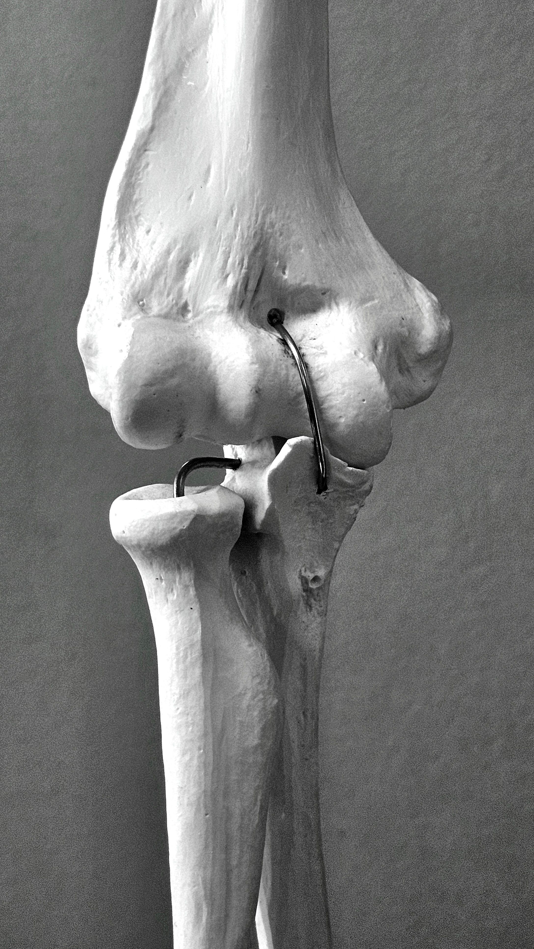 Orthopaedic Surgery