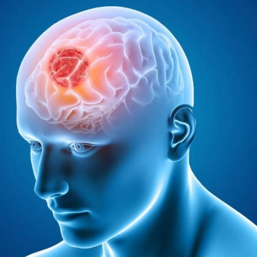 Neurology